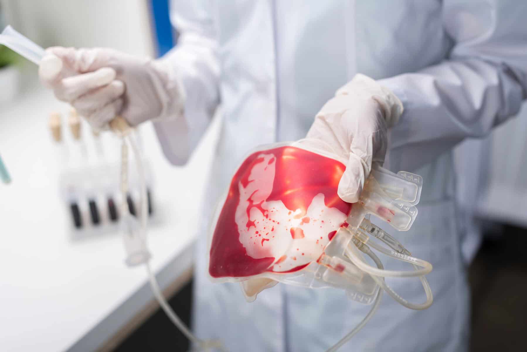 Stem Cell Infusion Therapy for Sexual Health